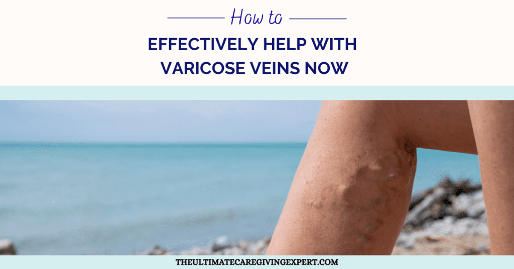 Varicose Veins