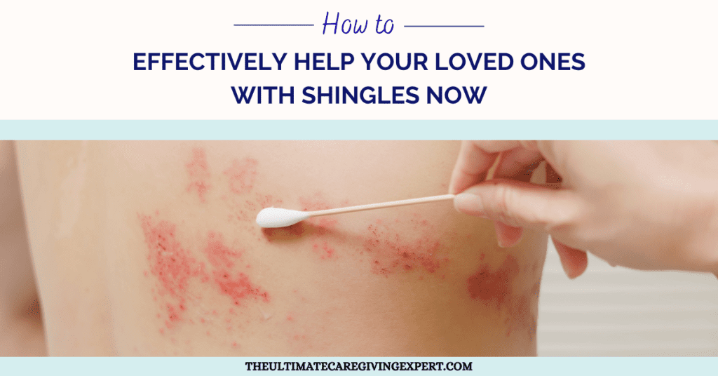 Shingles